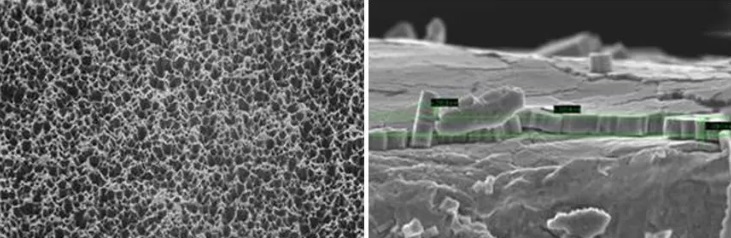 鋁打黑細節圖 鋁打黑細節圖